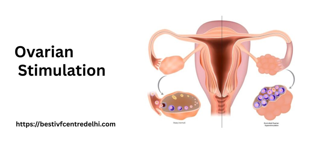 Ovarian Stimulation